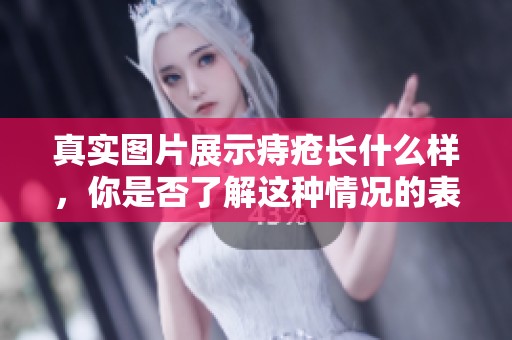 真实图片展示痔疮长什么样，你是否了解这种情况的表现呢