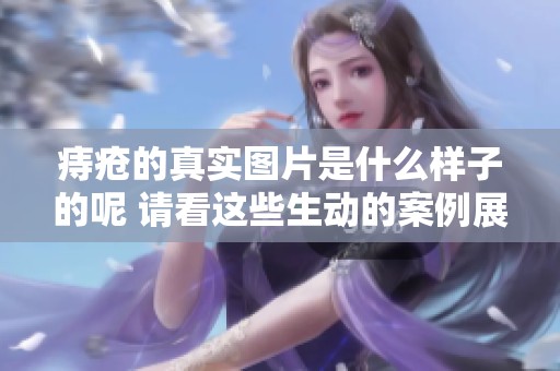 痔疮的真实图片是什么样子的呢 请看这些生动的案例展示